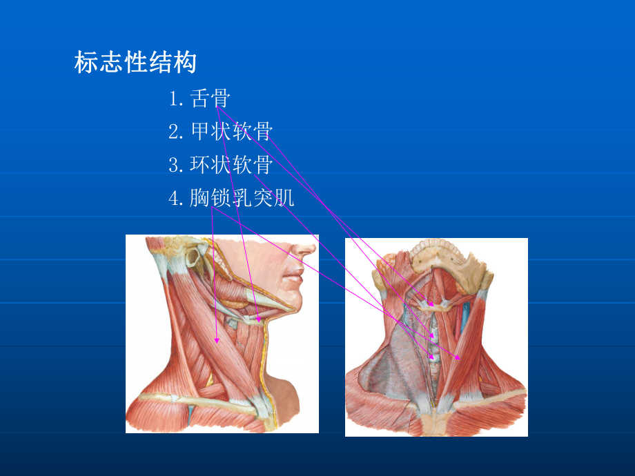 颈部淋巴结分区新版本课件.ppt_第2页