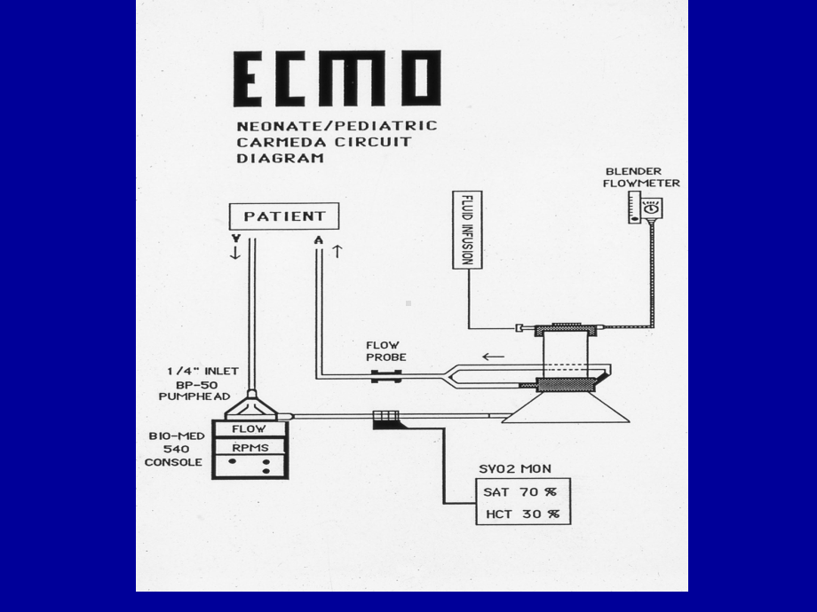 ECMOOXYGENATORSUniversityofMinnesotaMedicalECMO氧明尼苏达大学医学课件.pptx_第1页