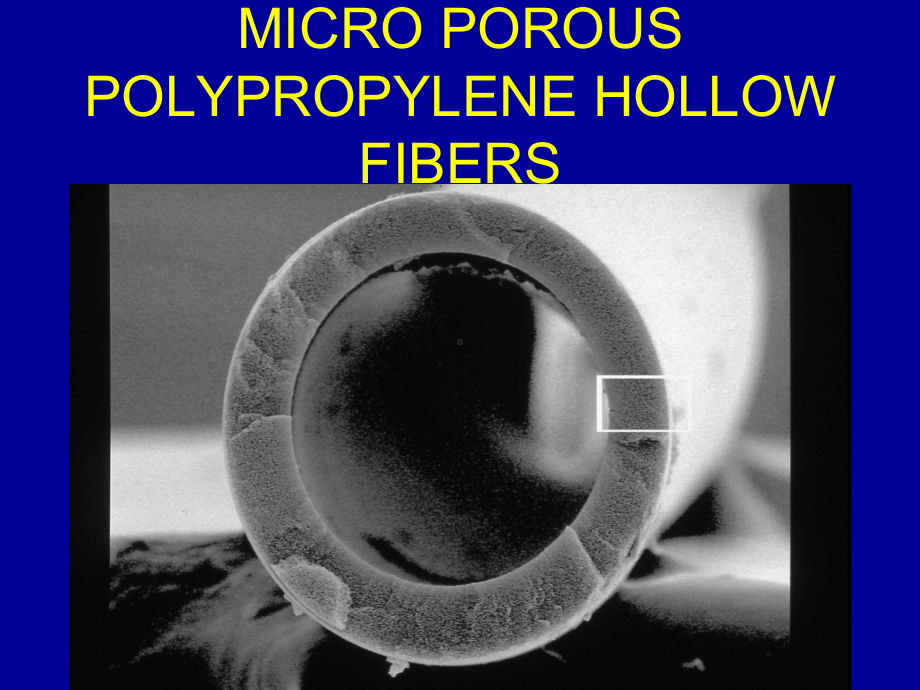 ECMOOXYGENATORSUniversityofMinnesotaMedicalECMO氧明尼苏达大学医学课件.pptx_第2页