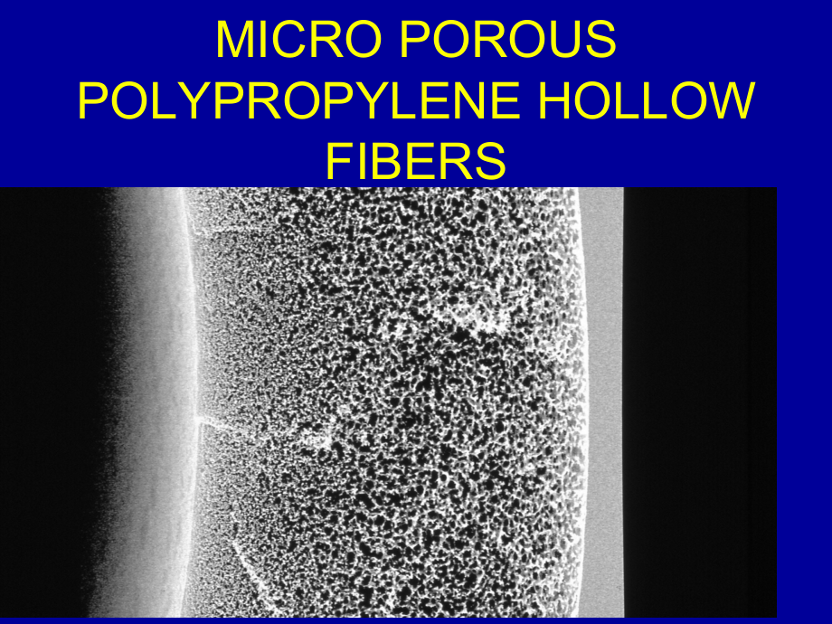 ECMOOXYGENATORSUniversityofMinnesotaMedicalECMO氧明尼苏达大学医学课件.pptx_第3页