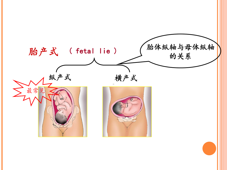 产科四步触诊法课件.ppt_第3页