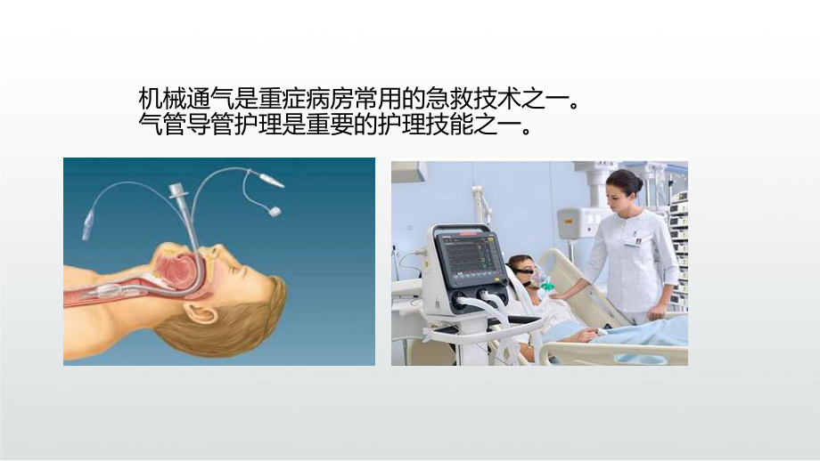 气囊压力监测PPT课件.ppt_第3页