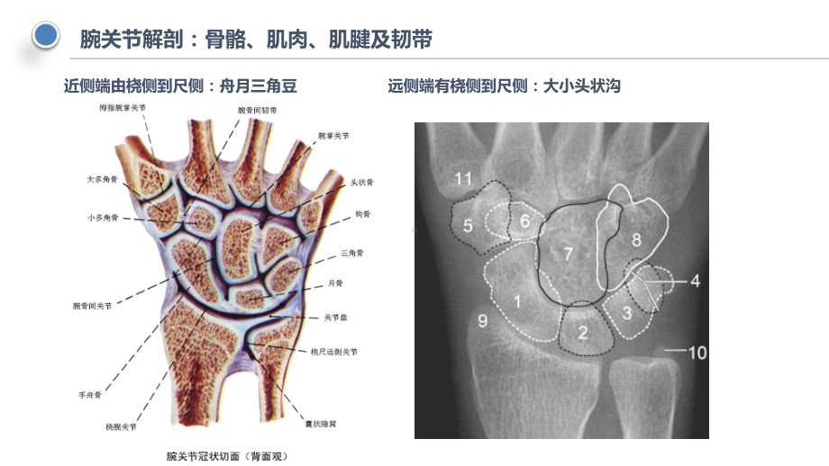 医学学习课件：腕关节解剖及MR检查.pptx_第3页