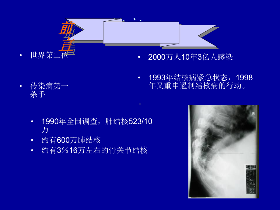 第六十九章骨与关节结核课件.ppt_第3页