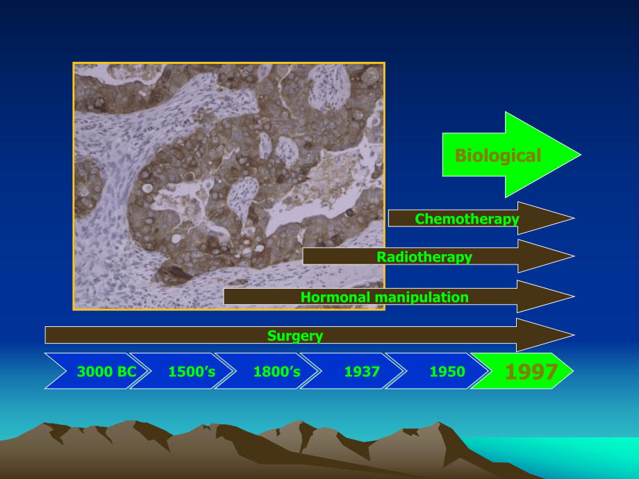 乳腺癌的分子分型课件.ppt_第2页