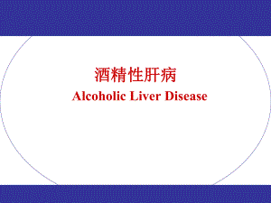 内科学课件：酒精性肝病.ppt