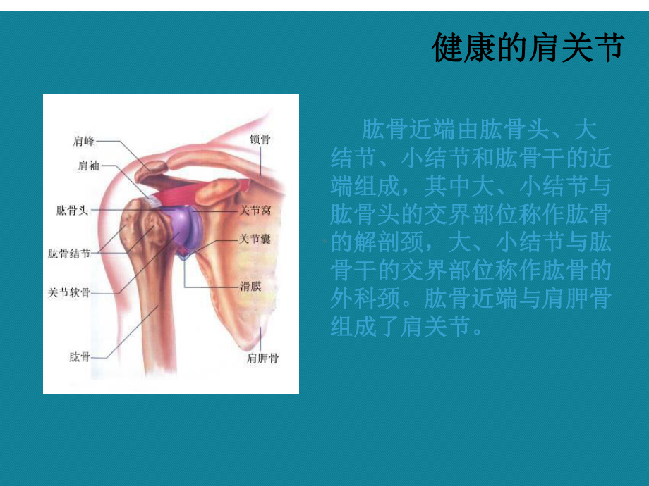 肱骨头置换围手术护理幻灯演示文稿课件.ppt_第3页