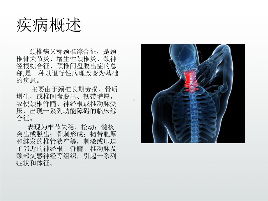 颈椎病健康知识课件.ppt_第3页