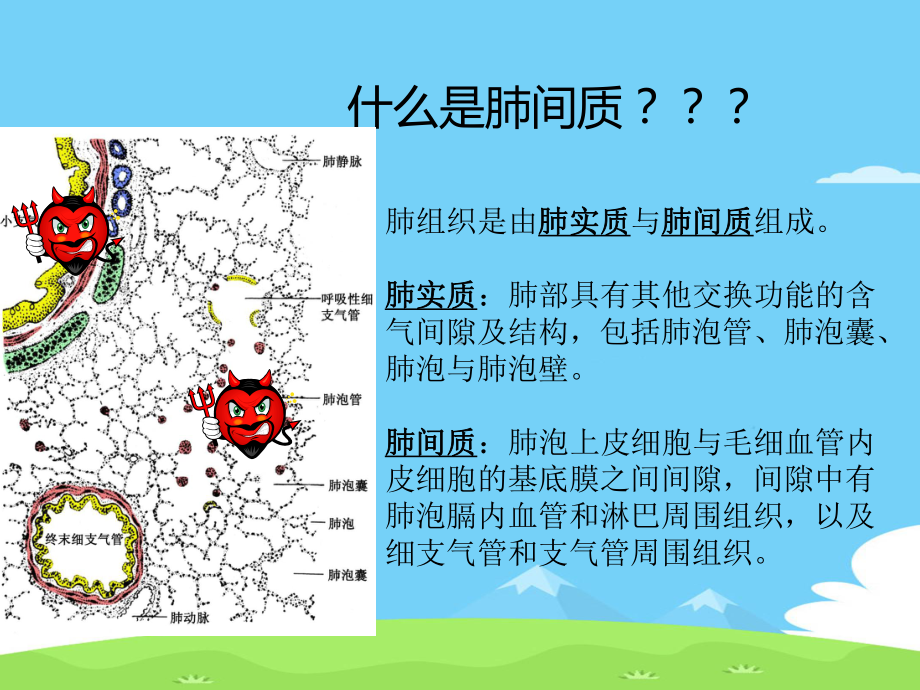 间质性肺炎护理查房精选优秀课件.ppt_第3页