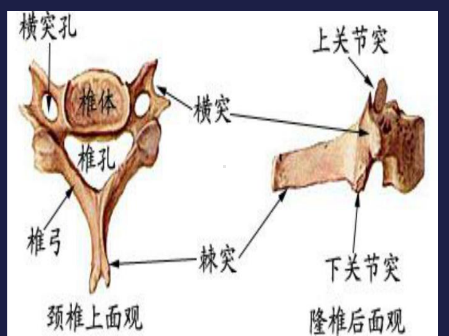 新版颈椎影像解剖学课件.ppt_第2页