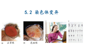 5.2 染色体变异 ppt课件(4)-2023新人教版（2019）《高中生物》必修第二册.pptx