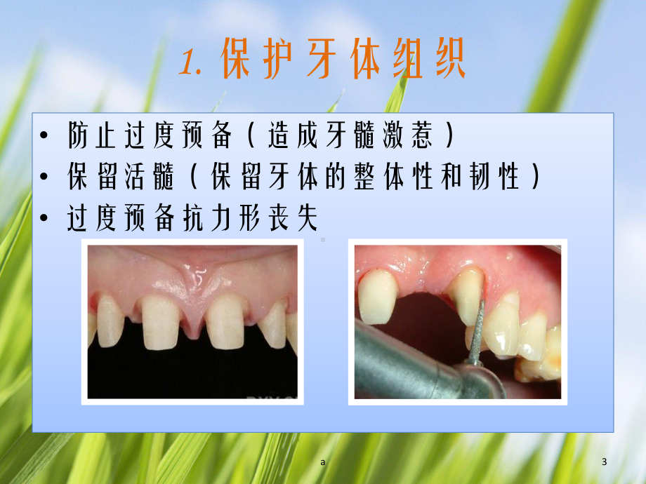 牙体预备的基本要点教学课件.ppt_第3页