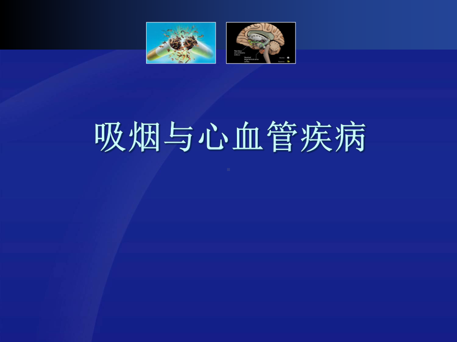 烟与血汗管疾病[资料]教学课件.ppt_第1页