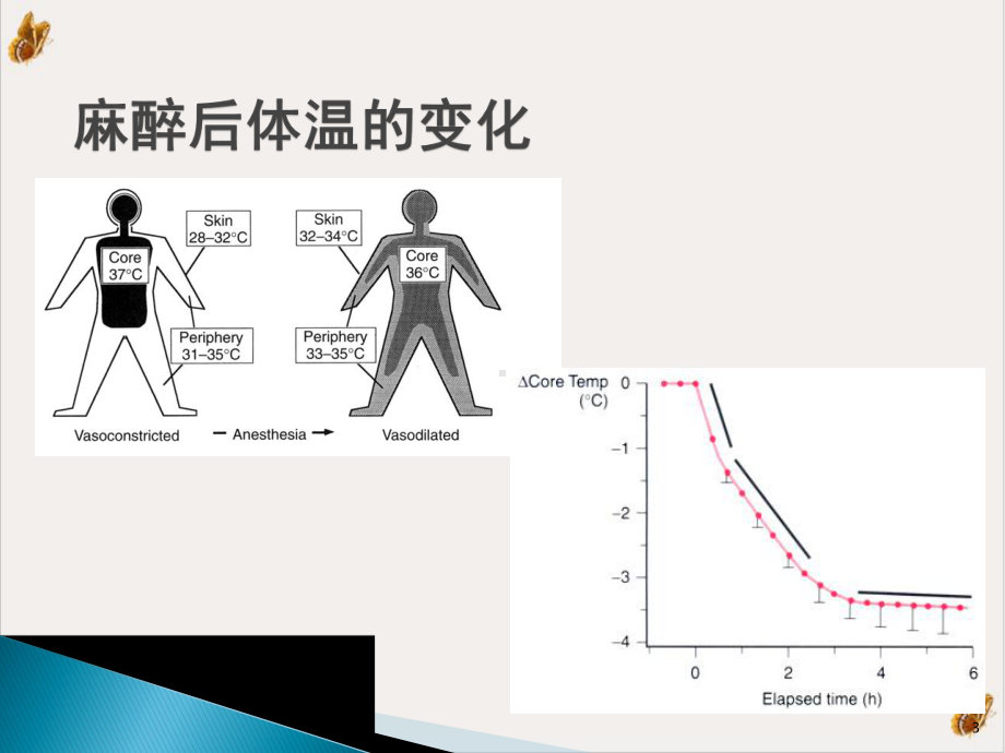 麻醉期间的体温管理教学课件1.pptx_第3页