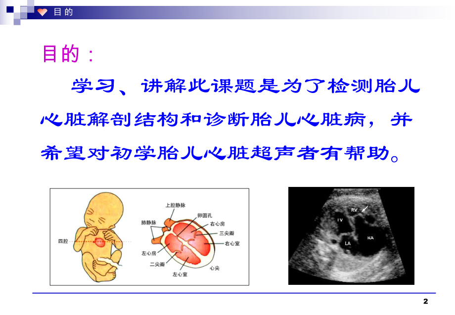 胎儿心脏解剖结构的超声判定教学课件.ppt_第2页