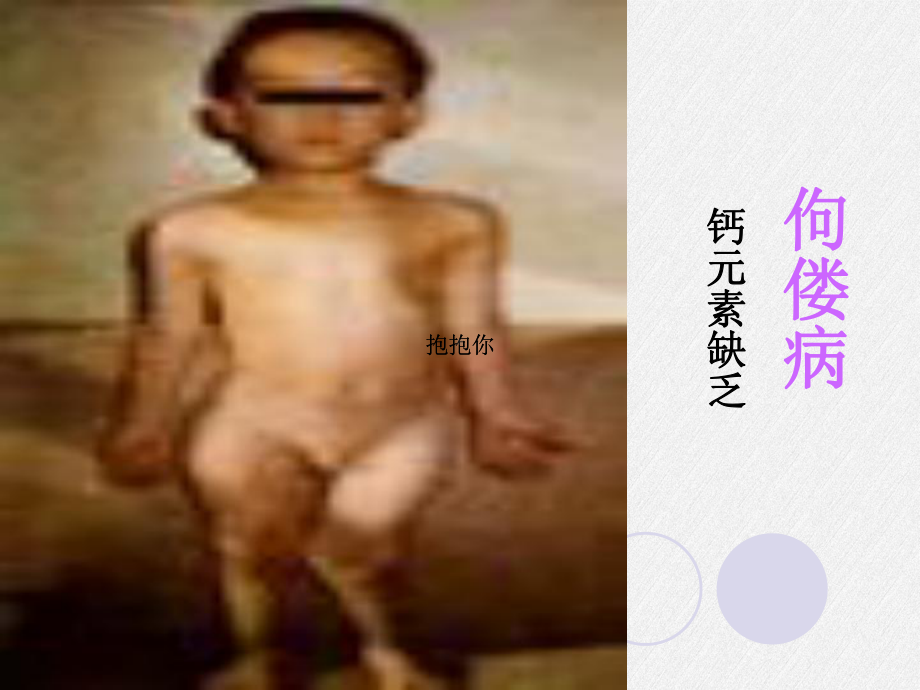 《化学元素与人体健康》课件-(市优)2022年九年级化学课件.ppt_第2页