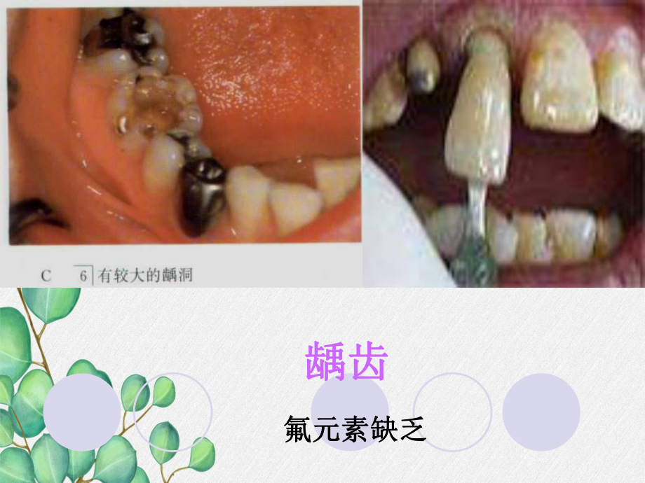 《化学元素与人体健康》课件-(市优)2022年九年级化学课件.ppt_第3页