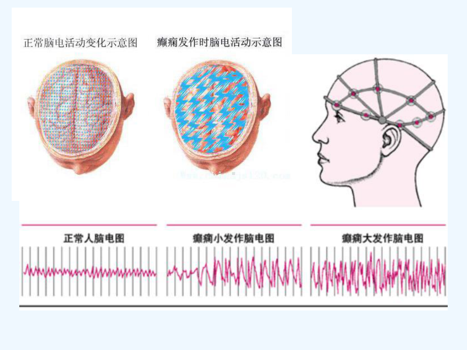 cq抗癫痫抗惊厥药教学课件.ppt_第2页