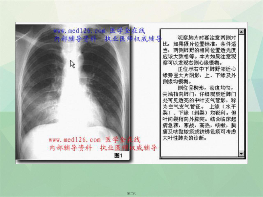 X线培训临床执业医师实践能考试讲课课件.ppt_第2页