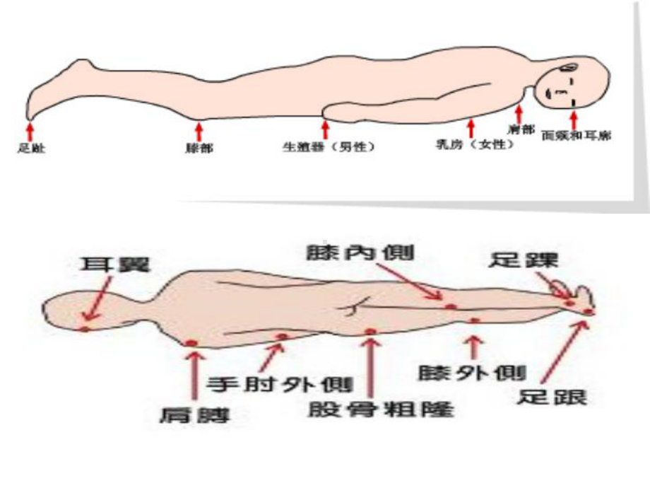 压疮湿性愈合理论课件.ppt_第3页