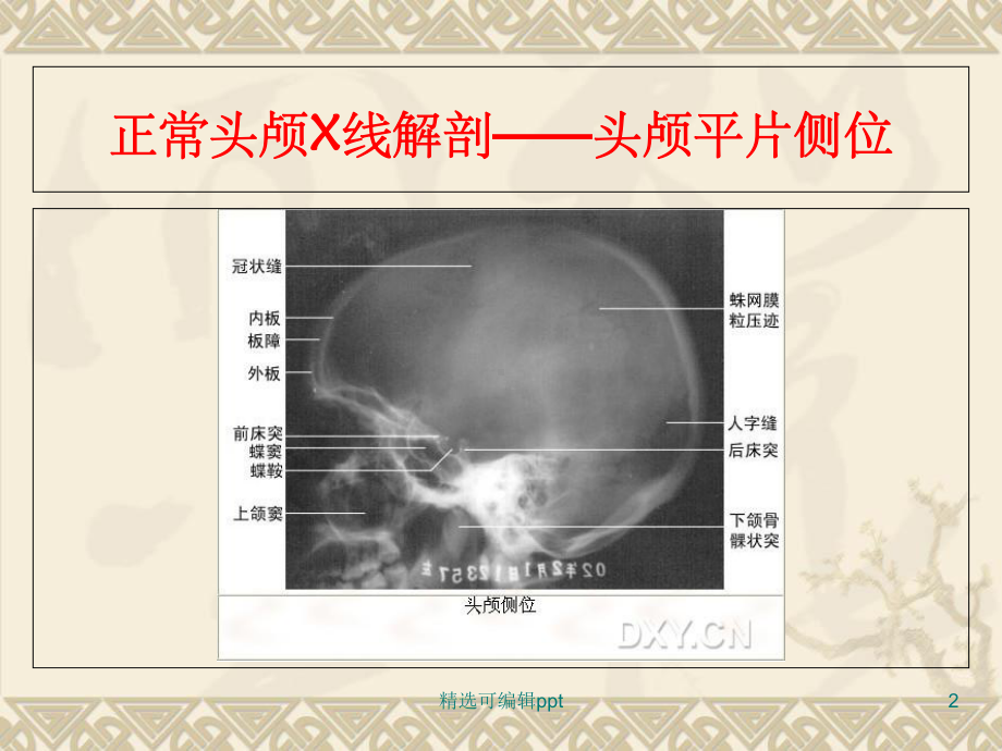 正常头颅X线解剖-头颅平片后前位课件.ppt_第2页