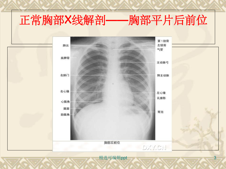 正常头颅X线解剖-头颅平片后前位课件.ppt_第3页