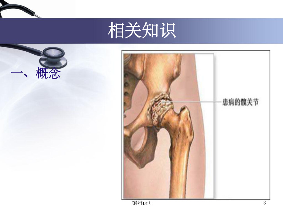 人工全髋关节置换术5课件.ppt_第3页