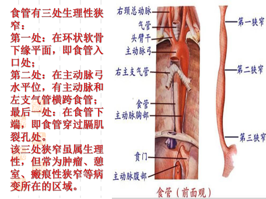 食道癌护理教学查房课件.ppt_第3页