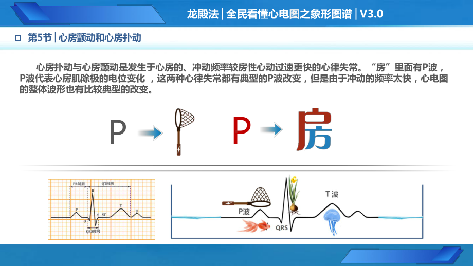 PPT课件第5节心房颤动和心房扑动龙殿法原创全民看懂心电图象形图谱健康宣教科普讲座.pptx_第3页