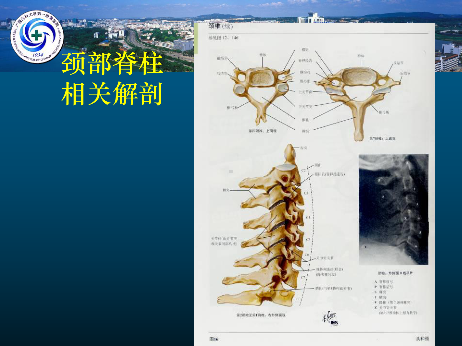 颈椎病的MRI诊断(黄仲奎).ppt_第3页