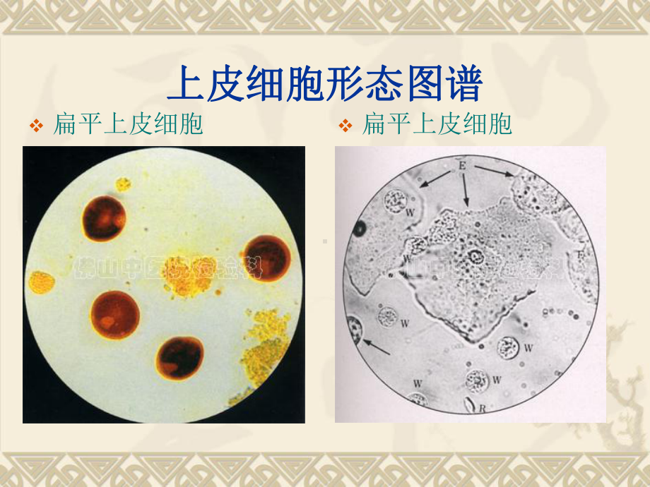 尿沉渣图片整理.ppt_第3页