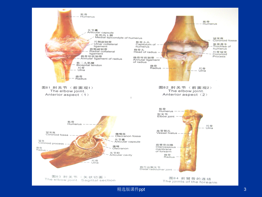 小儿肱骨髁上骨折1课件.ppt_第3页