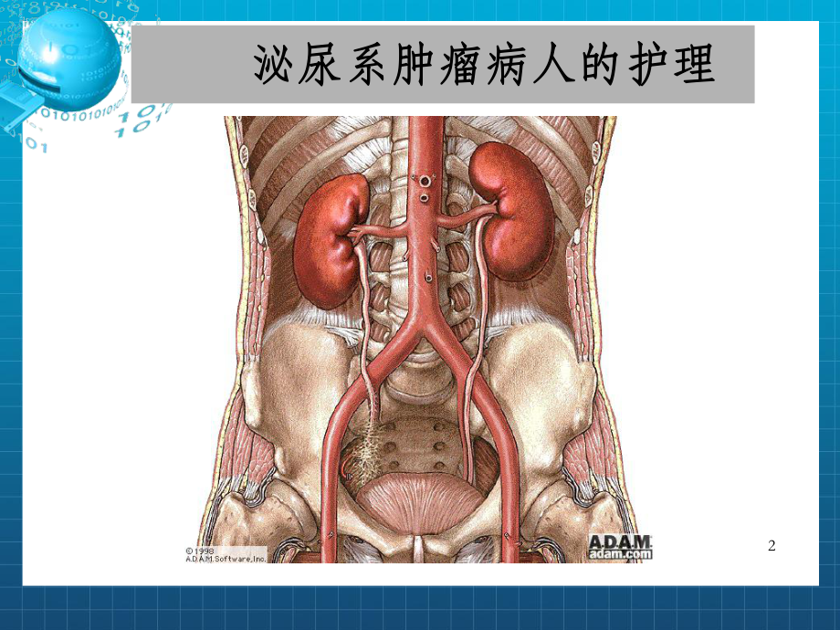 教学情境三十八泌尿系肿瘤病人的护课件.ppt_第2页