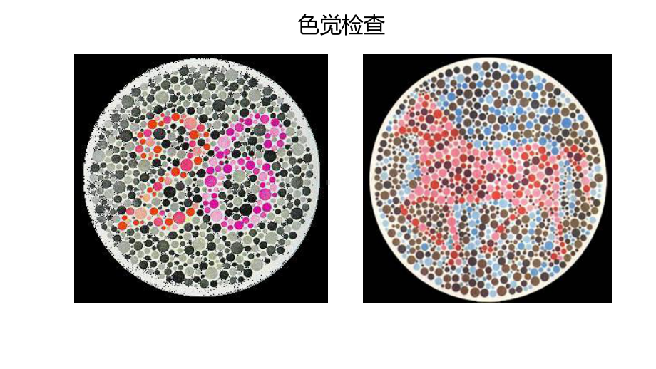 2.3伴性遗传ppt课件(同名2)-2023新人教版(2019）《高中生物》必修第二册.pptx_第2页