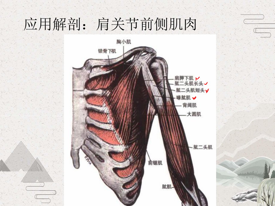 肩关节C形针刀松解术治疗肩周炎课件.pptx_第2页