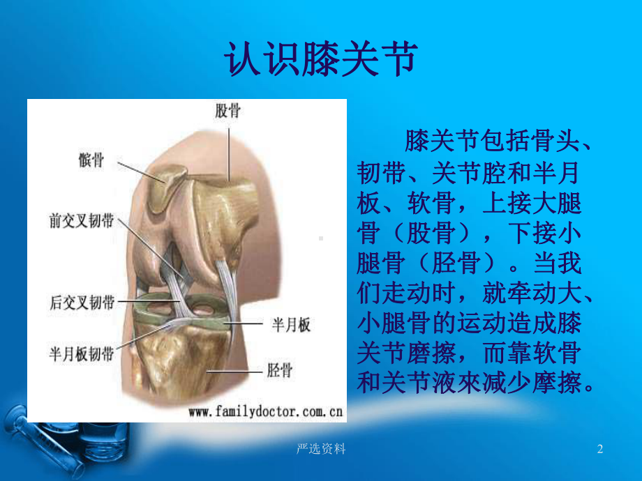 人工全膝关节置换术详细(医学材料)课件.ppt_第2页