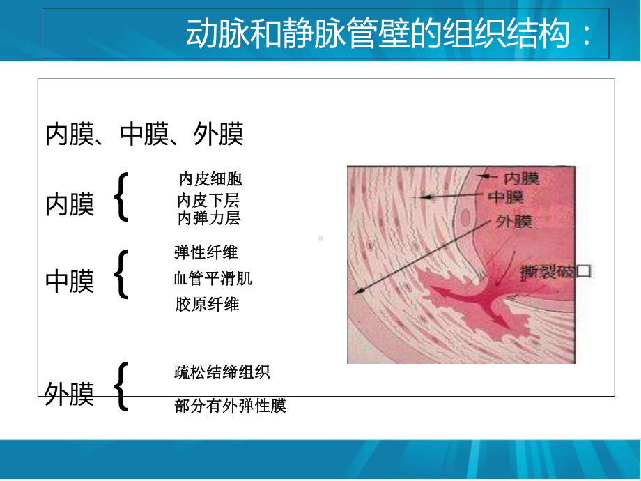 主动脉夹层治疗课件.ppt_第2页