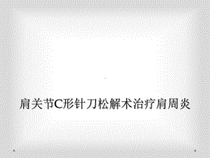 肩关节C形针刀松解术治疗肩周炎课件.ppt