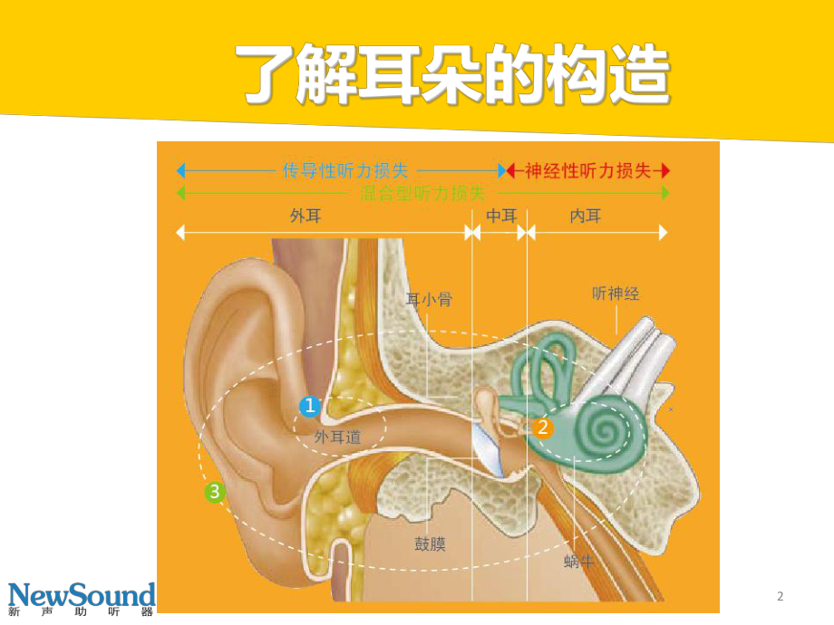 什么是听力损失及解决方法？.ppt_第3页