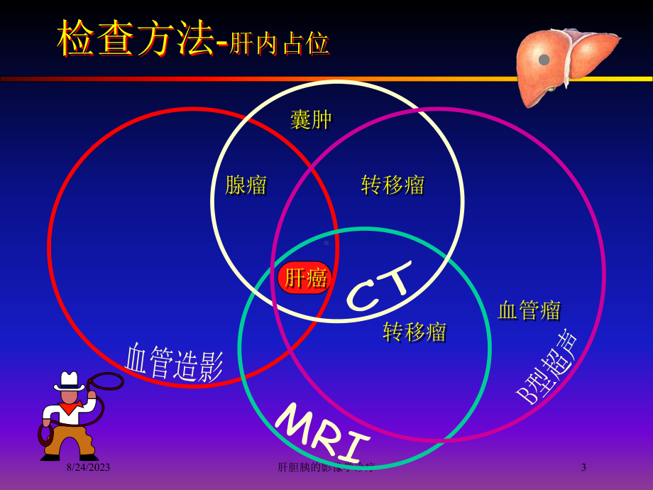 肝胆胰的影像学诊疗培训课件.ppt_第3页