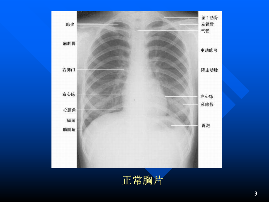 血透病人的饮食与营养22222课件.pptx_第3页