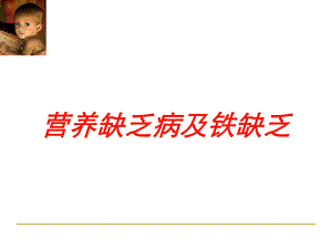 营养缺乏病及铁缺乏培训课件.ppt