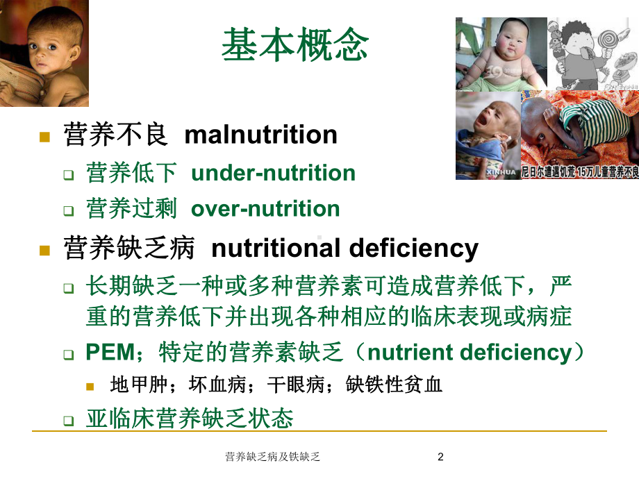 营养缺乏病及铁缺乏培训课件.ppt_第2页