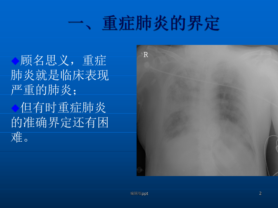 重症肺炎的诊治1课件.ppt_第2页