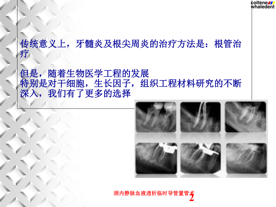 颈内静脉血液透析临时导管置管术培训课件.ppt_第2页