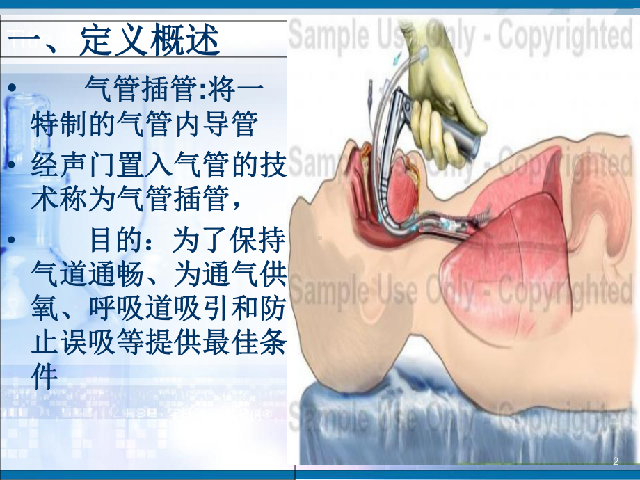 气管插管护理教学课件.ppt_第2页