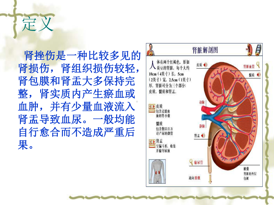 肾挫伤病人的护理查房教学课件.ppt_第2页