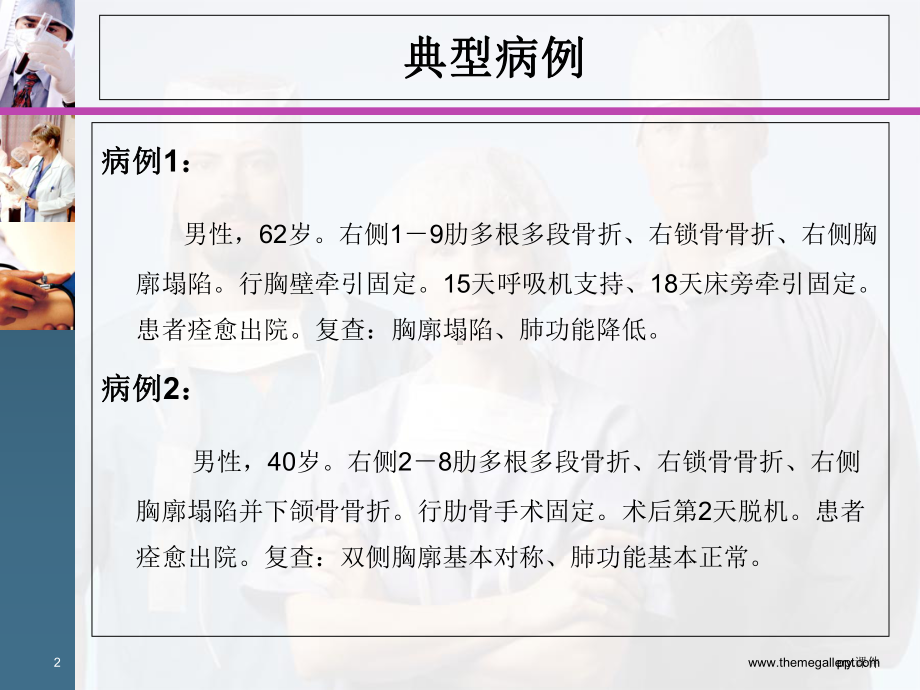 连枷胸-教学讲解课件.ppt_第2页