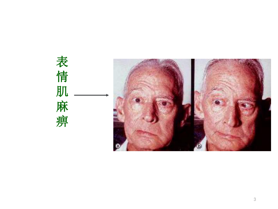 骨骼肌-教学讲解课件.ppt_第3页