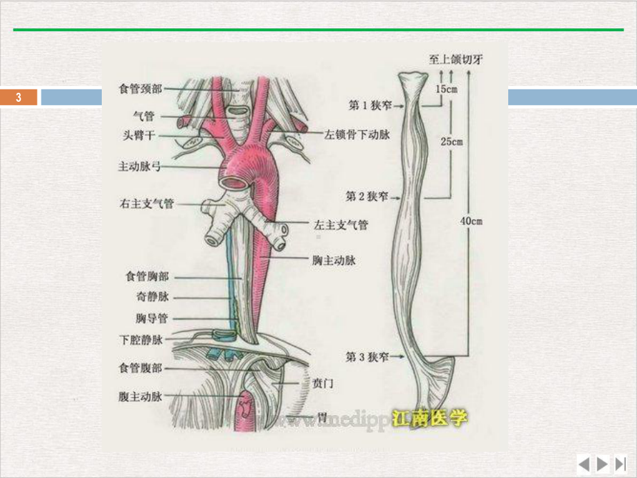 食管瘘的观察及护理完整版课件.pptx_第3页